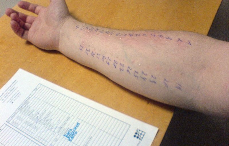 Typy testów alergicznych